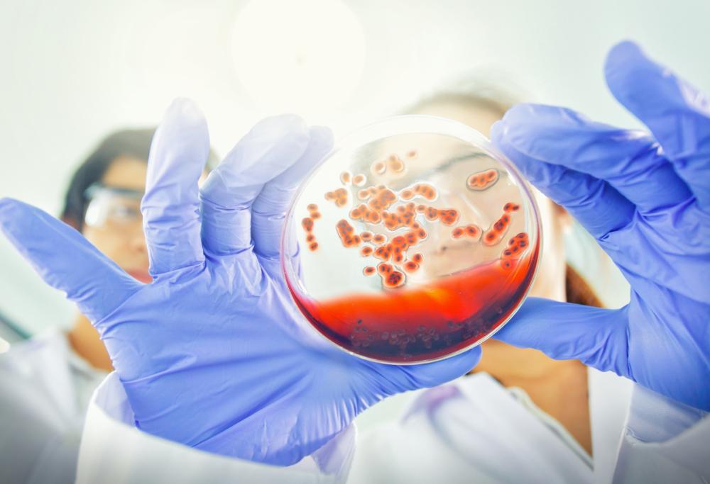 I primi segni di tumore individuati con un esame del sangue: lo studio italiano