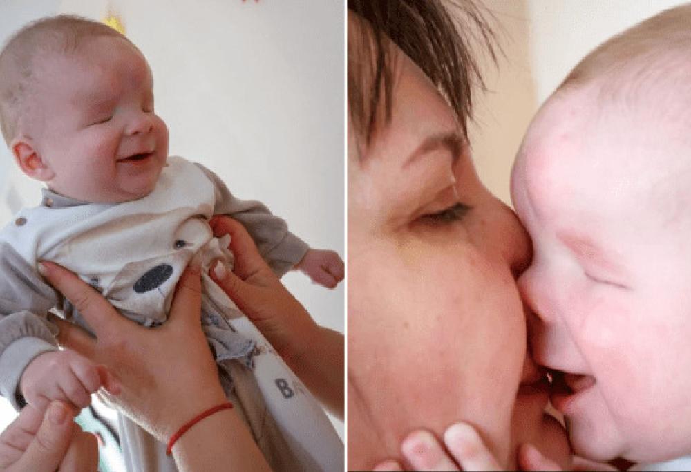 Questo bimbo è nato senza occhi e ora cerca una famiglia: la storia di Sasha