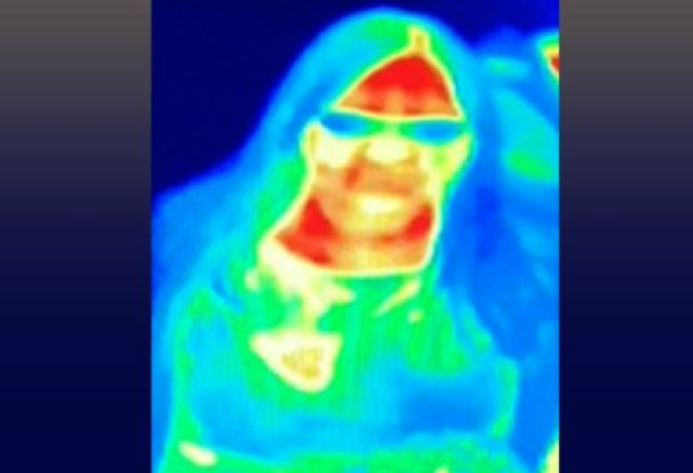 Scopre il tumore al seno grazie alla fotocamera termica del museo
