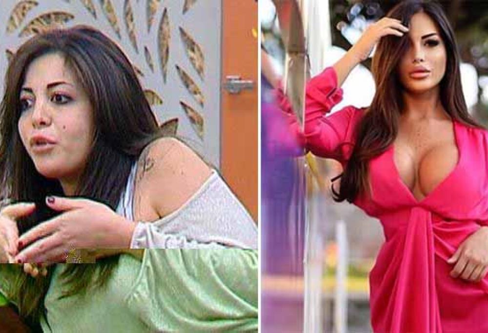 La trasformazione di Floriana Messina (ex Grande Fratello 12) dopo i ritocchini 