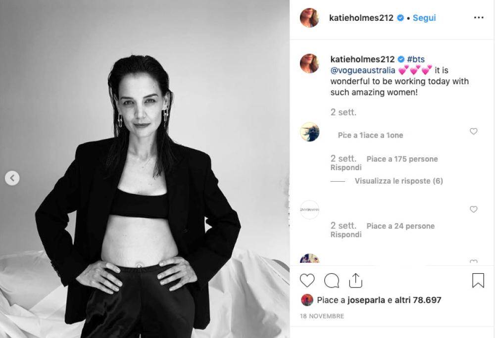 Katie Holmes ha le smagliature e le mostra senza problemi [foto]