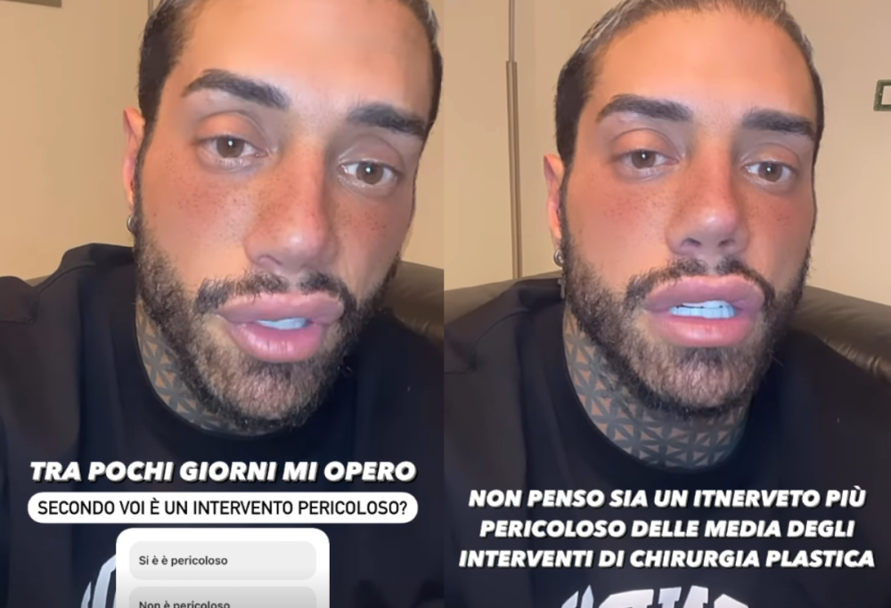 Francesco Chiofalo cambia il colore degli occhi: "È un mio sogno"