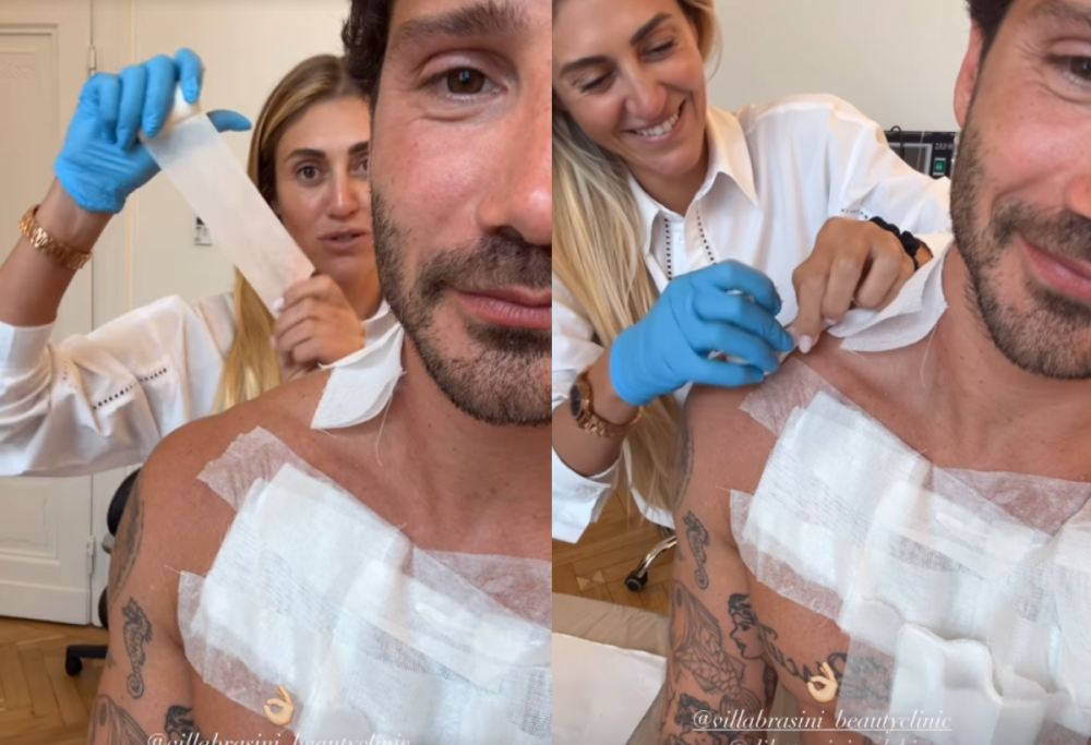 Stefano De Martino volta pagina e rimuove il tatuaggio per Belen