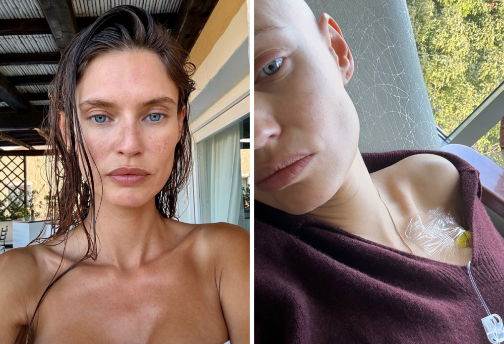 Bianca Balti, la prossima chemio sarà l’ultima: come sta la modella