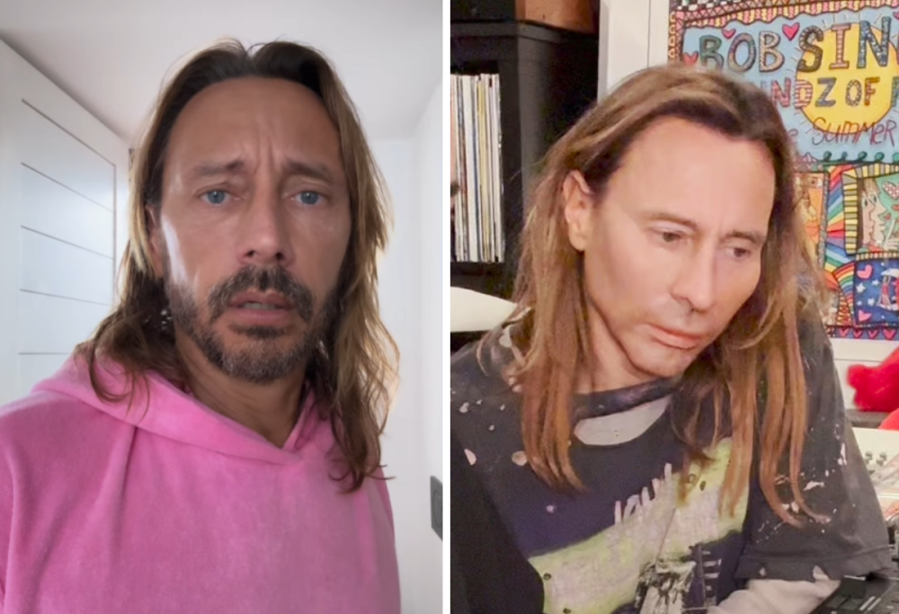 Bob Sinclar irriconoscibile sui social: si è sottoposto al botox?