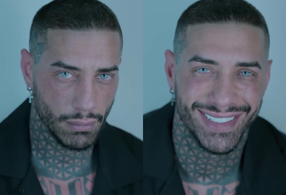 Chiofalo e il trapianto di barba: “Ho paura di essere sfigurato”