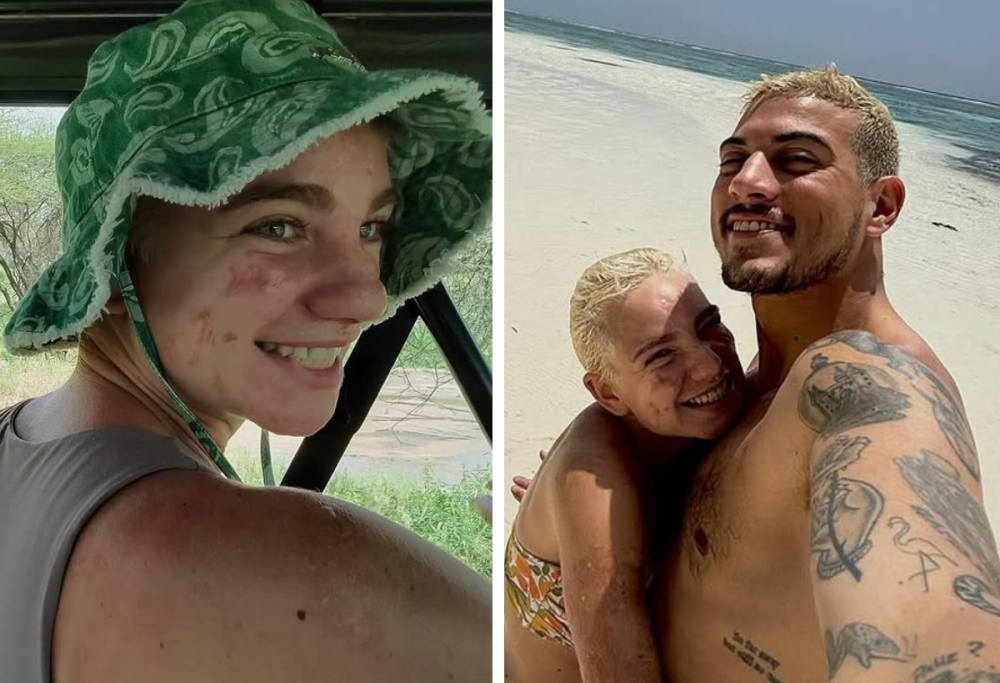 Bebe Vio, prima foto insieme al fidanzato: chi è Gianmarco Viscio