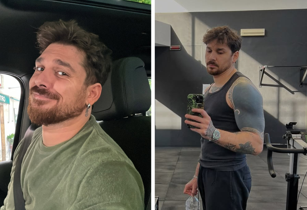 Andrea Cerioli e la liposuzione: “Avevo preso 29 chili in un mese”