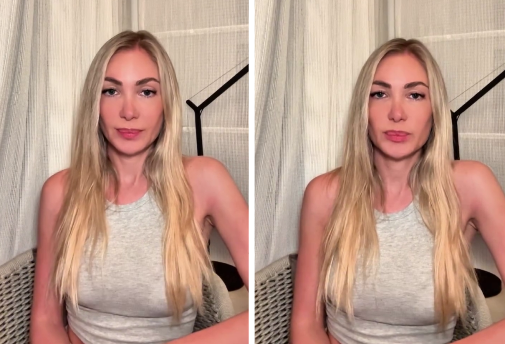 Laura Cremaschi: “Le labbra così non sono un mio capriccio estetico”