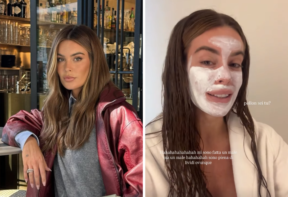 L’incidente di Sophie Codegoni: “Mi sono spaccata mezza gamba”