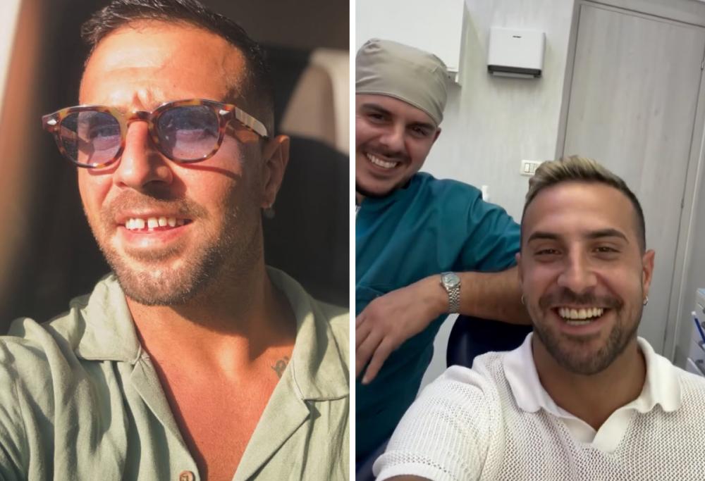 Antonio Panico prima e dopo “Temptation Island”: come è cambiato