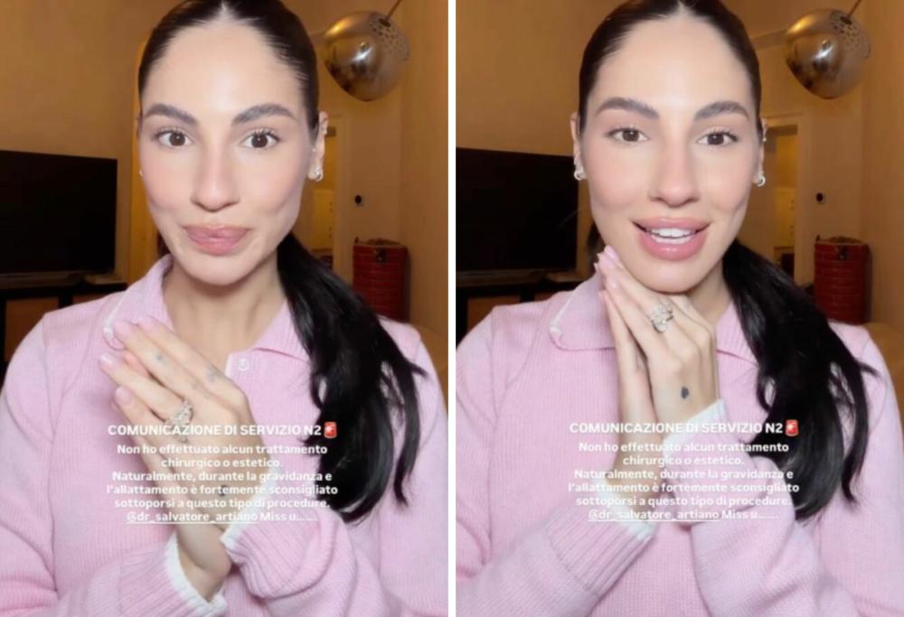 Giulia De Lellis ha fatto le punturine dopo il parto? La sua replica