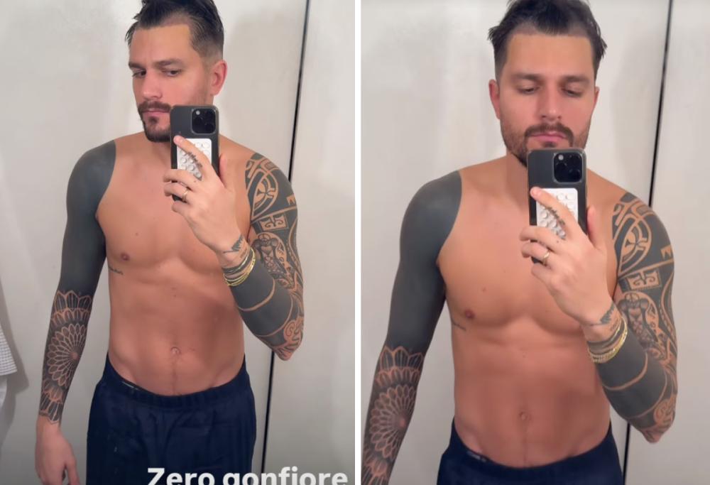 Zelletta si sottopone a un trapianto di capelli: “Ero insicuro”