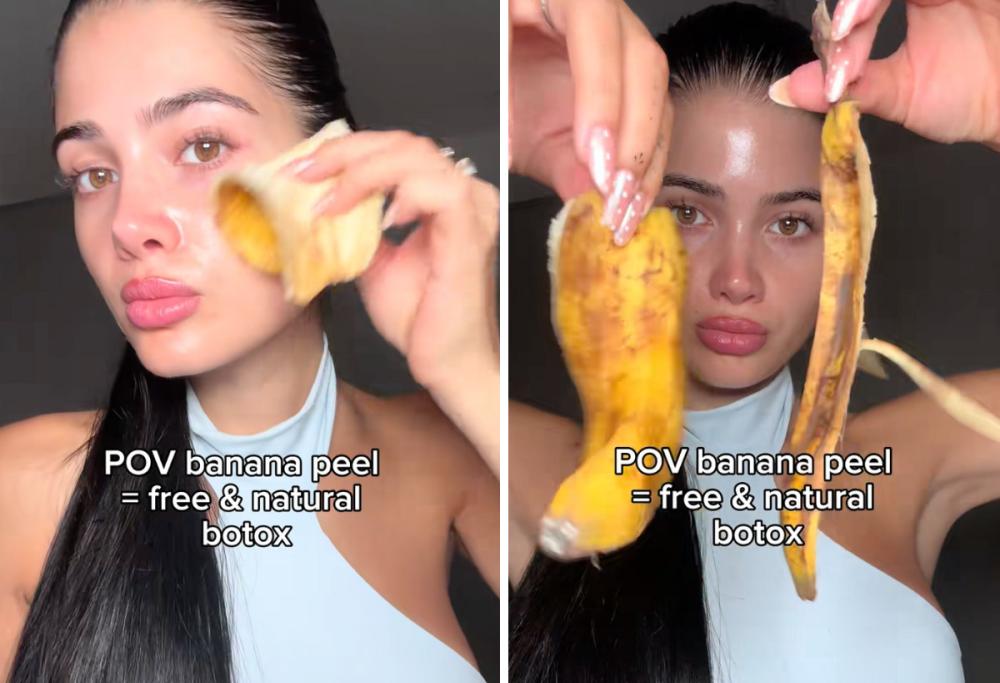 “Banana Botox”: il trend TikTok della buccia di banana per la pelle