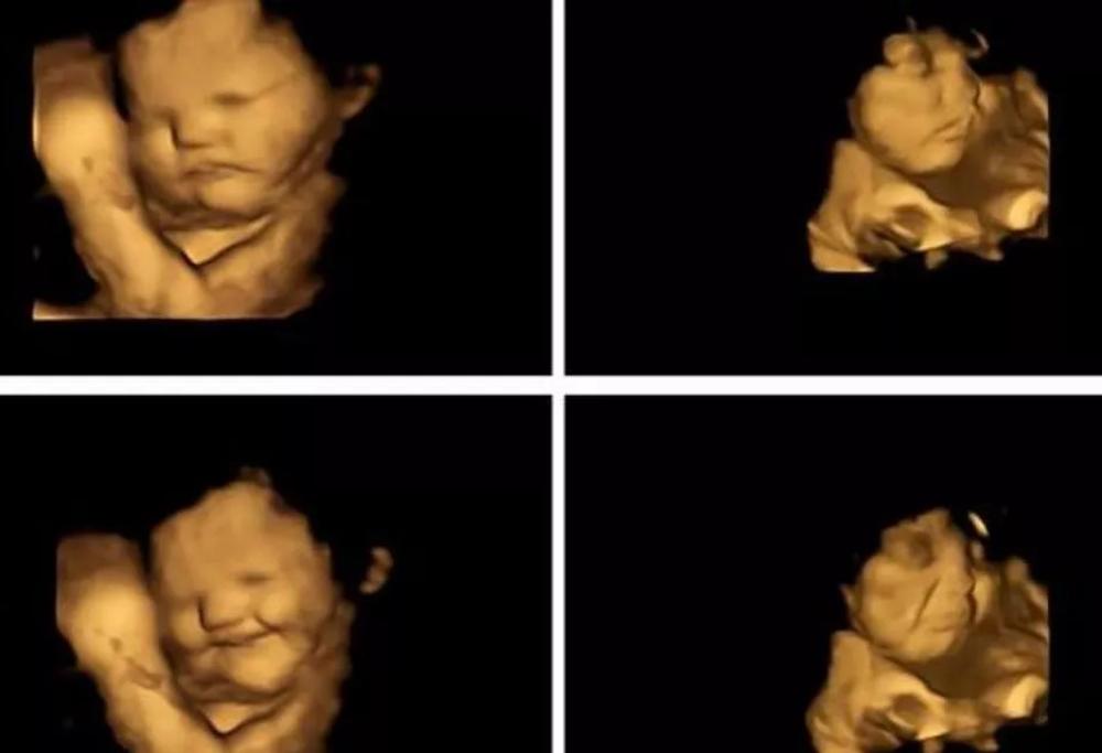 I bambini nella pancia della mamma reagiscono al cibo con lacrime o sorrisi