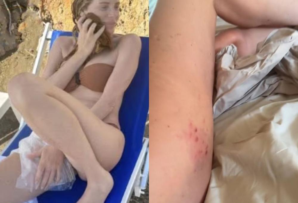 Alessia Marcuzzi, incidente sulle rocce: le immagini dopo la caduta