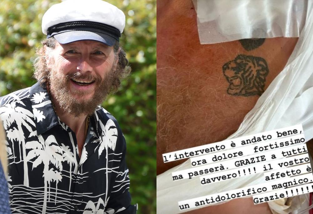 Jovanotti, le parole post incidente: "L'intervento è andato bene"
