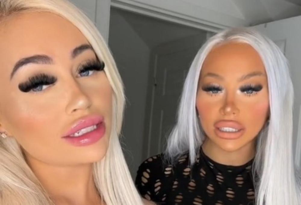OnlyFans: due gemelle spendono 160 mila € per somigliarsi di più
