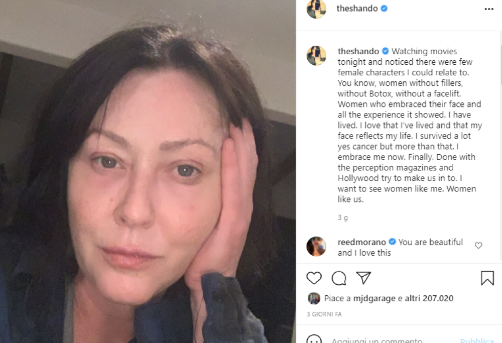 Shannen Doherty: “Ho vissuto e sofferto, il mio volto riflette la mia esistenza”