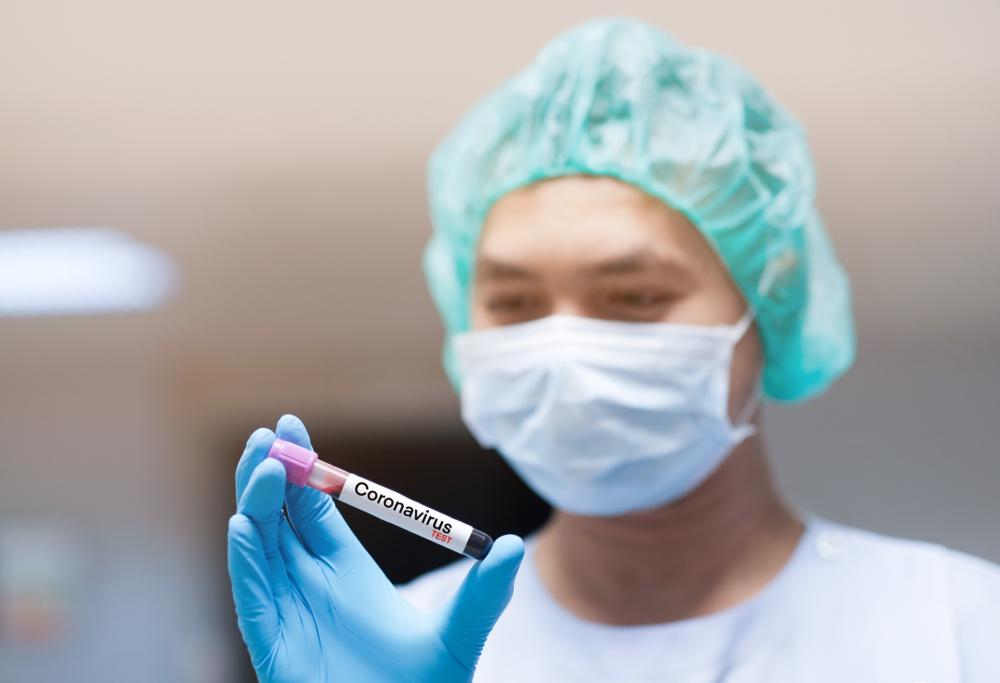 Se la popolazione non è immune il caldo e l’umidità non fermano il Coronavirus: lo rivela uno studio