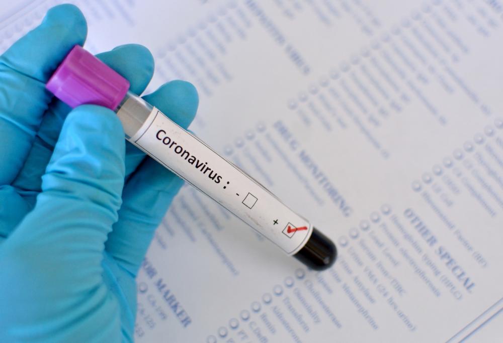 Coronavirus, azienda americana sta lavorando sul primo vaccino sperimentale 