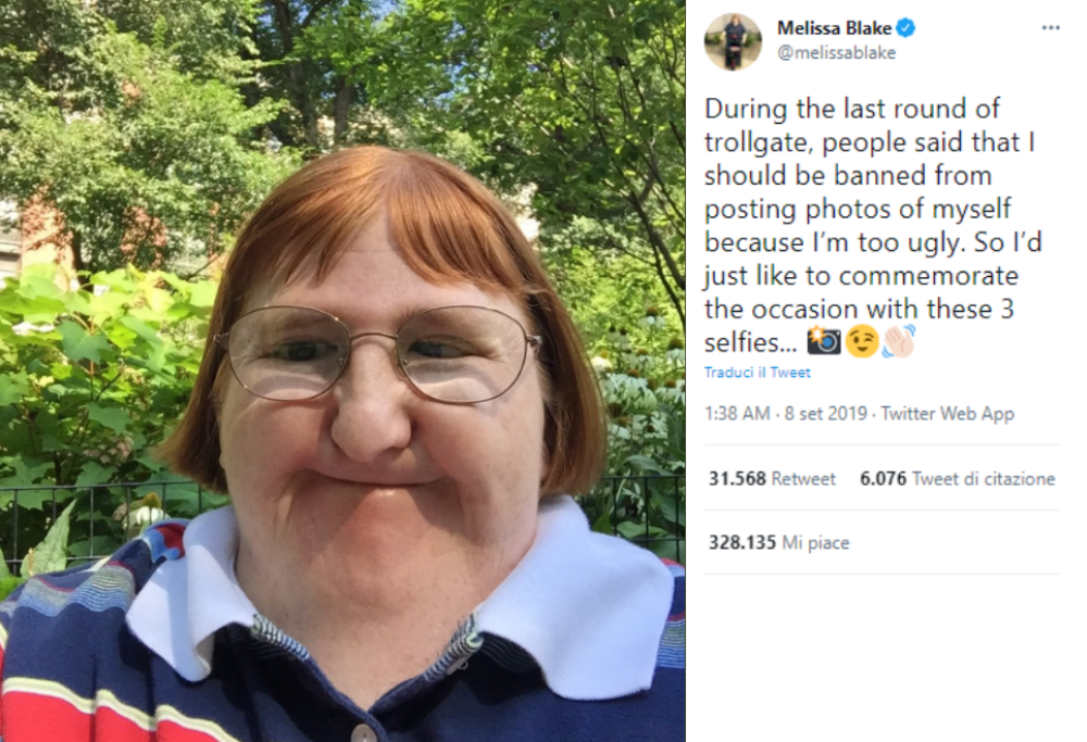 Melissa Blake affetta da una malattia rara ha sommerso i social con i suoi selfie per vendicarsi degli insulti 