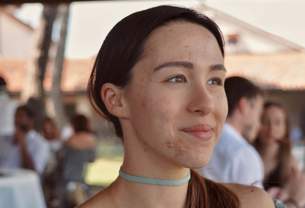 Aurora Ramazzotti pubblica una foto senza filtri: “Per postare una foto così, come l’hai scattata, ormai ci vuole coraggio"