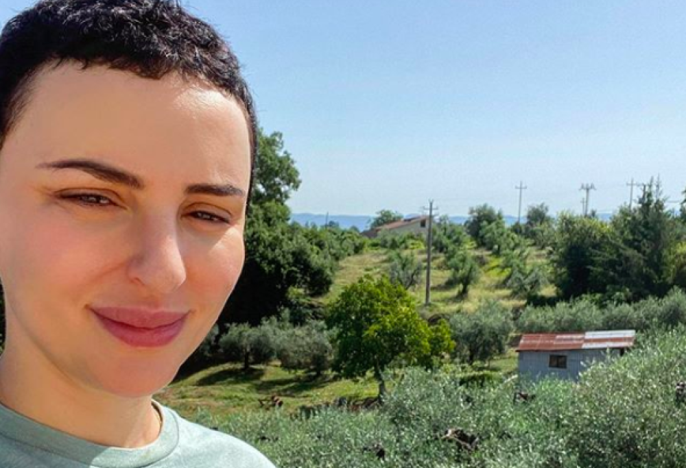 Arisa e la rivelazione sui ritocchini