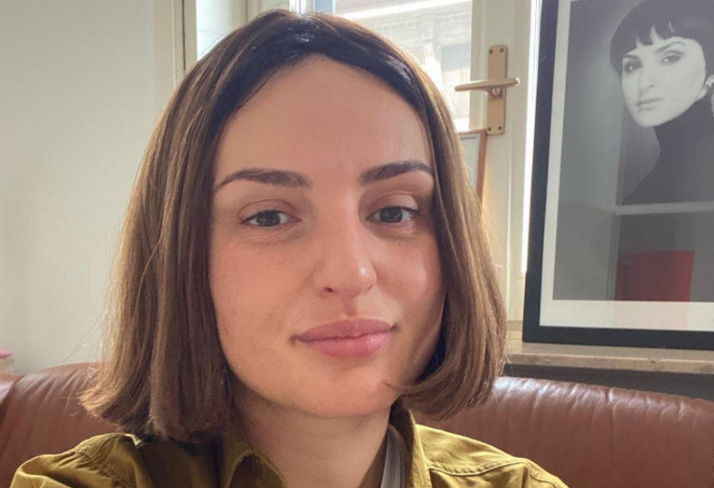Arisa lancia un messaggio di body positivity: “Ho deciso di tornare allo stato originale della mia faccia”