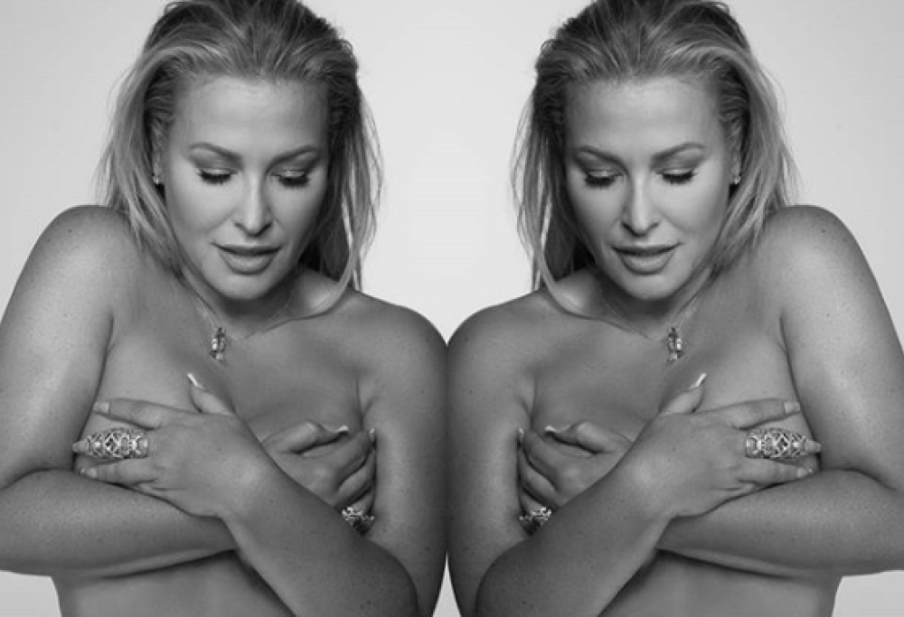Anastacia e la lotta al cancro al seno: "Non rimandate la mammografia a causa del Covid"