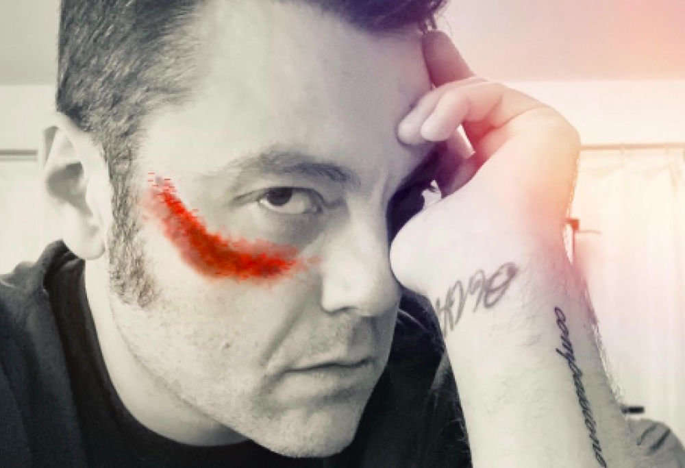 Tiziano Ferro sostiene le donne vittime di violenza con un post forte ma necessario