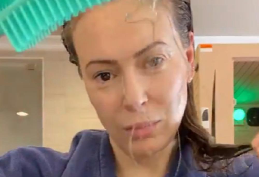 Alyssa Milano di "Streghe" mostra i capelli persi a causa del Covid-19