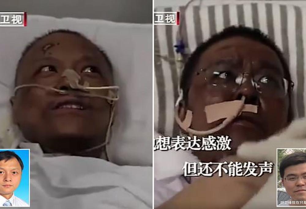 Due medici cinesi contagiati a Wuhan si sono risvegliati con la pelle scura