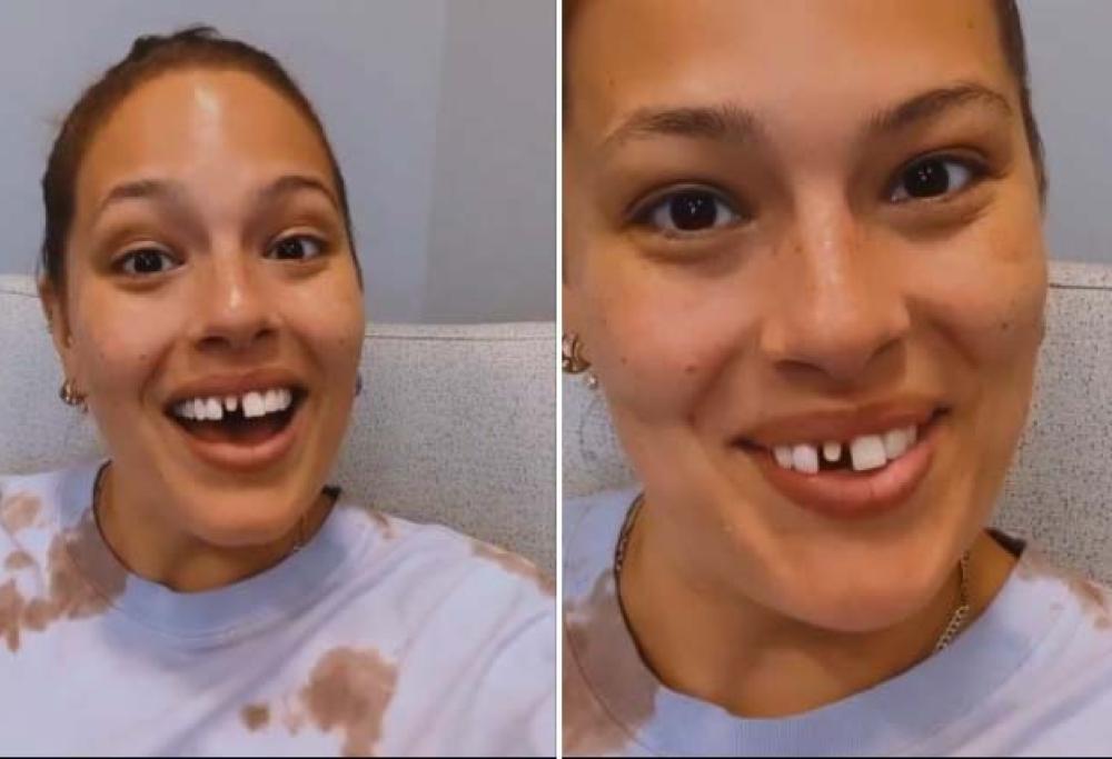Ashley Graham si fa male con un biscotto congelato e rimane sdentata