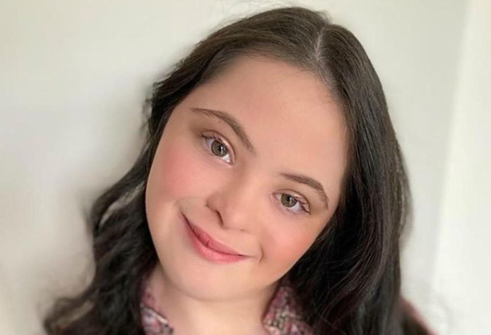 Ellie Goldstein è la prima modella con sindrome di Down a posare per Gucci