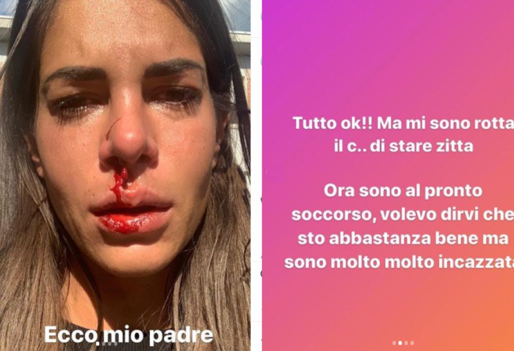 Giada Giovanelli shock, sanguina dal naso in una Storia: «Ecco mio padre»