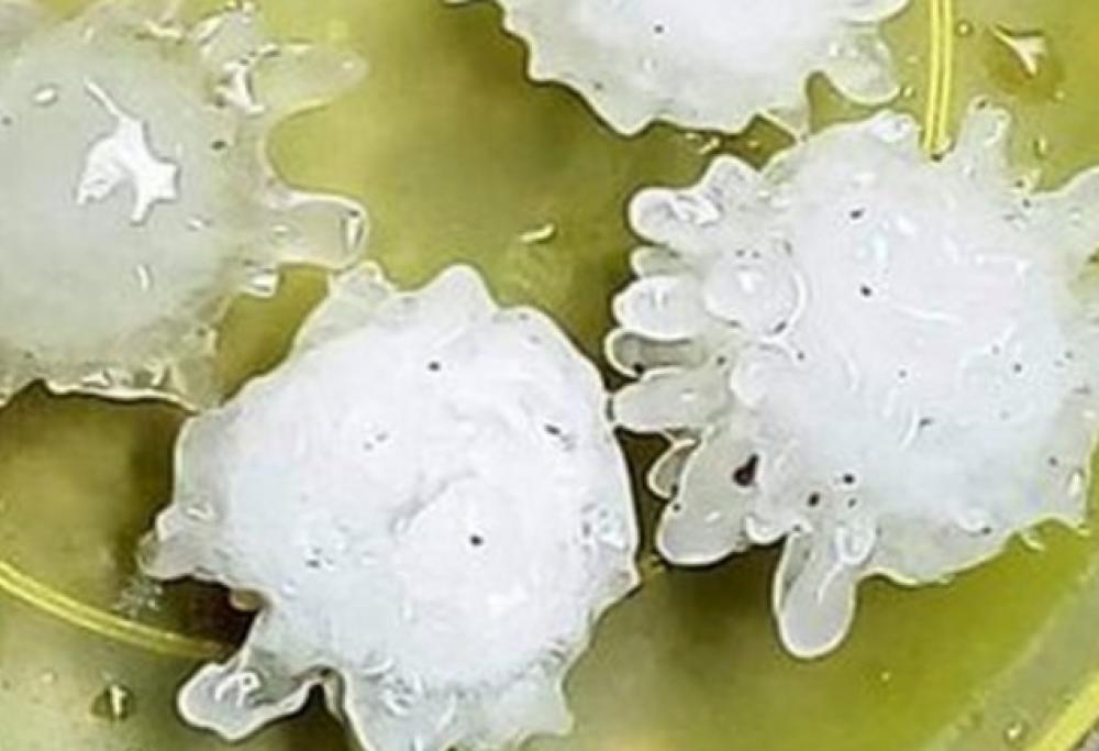Grandine a forma di Coronavirus? I meteorologi rassicurano: “Fenomeno normale”