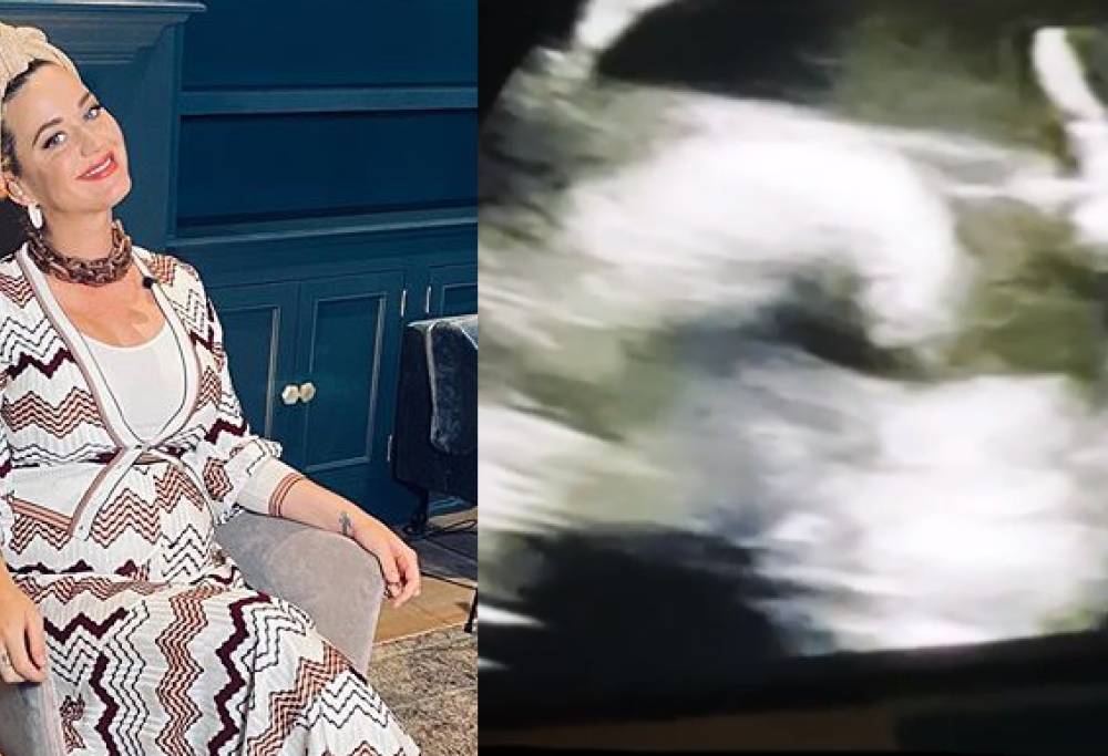 L'ecografia divertente di Katy Perry: la figlia mostra il dito medio