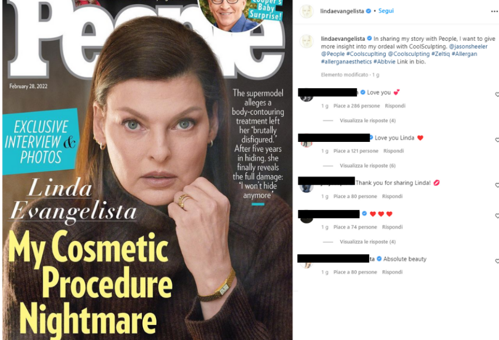 Linda Evangelista rompe il silenzio e racconta delle sue deformazioni fisiche 