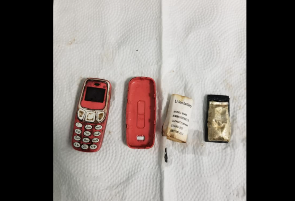 Kosovo: ingoia un 3310 intero. I medici lo salvano