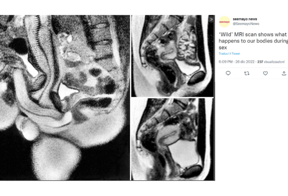 Fanno sesso durante la risonanza magnetica, ma in nome della scienza