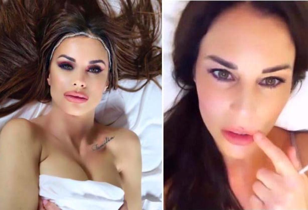 Antonella Mosetti rimuove l'acido ialuronico dalle labbra: "Erano enormi"