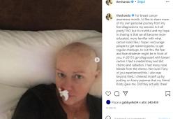 Shannen Doherty pubblica due foto di lei malata per sensibilizzare alla lotta contro il cancro 