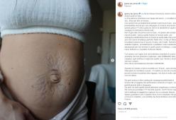 Gracia de Torres mostra la sua pancia dopo il parto gemellare: “Ad alcuni  farà terrore”

