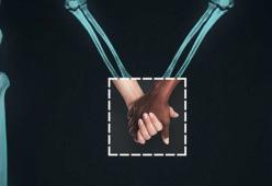 L’amore ai raggi X: quando amiamo non esistono distinzioni. 