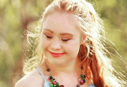 Madeline Stuart: la 18enne affetta dalla sindrome di down diventa una modella
