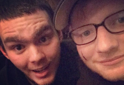 Ed Sheeran scherza sulla cicatrice sul suo viso

