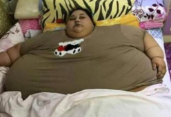 La donna più grassa del mondo vuole dimagrire: pronta a operarsi per perdere 390 kg