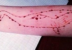 Blue Whale, un “gioco” che è costato la vita a 130 ragazzi