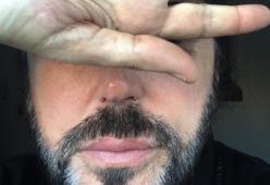 Scialpi vittima di un episodio di omofobia